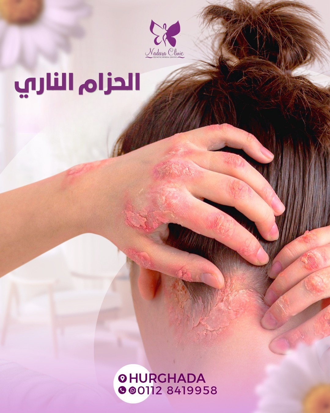 الحزام الناري في الغردقة